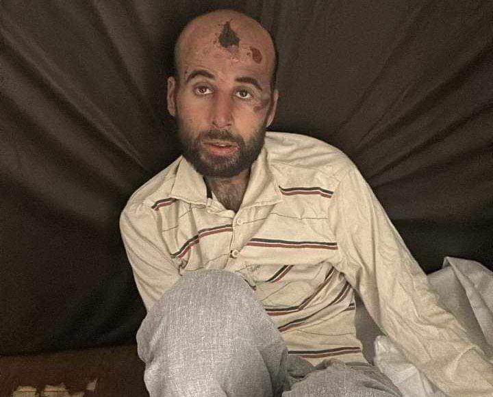 اللاجئ السوري علي عبد الباقي الذي قتل جراء اعتداء عنصري في لبنان